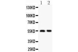 Anti-HDAC2 antibody,  Western blotting All lanes: Anti HDAC2 () at 0. (HDAC2 anticorps  (C-Term))