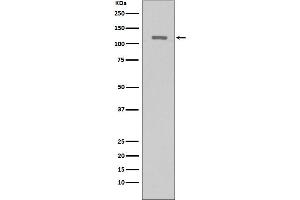 Western blot analysis of TERT expression in Hela cells lysate.