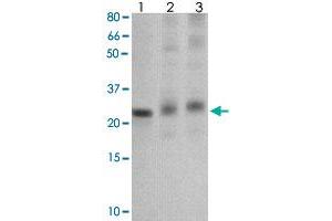The tissue/cell lysate derived from mouse liver (Lane 1), mouse muscle (Lane 2) and MCF-7 (Lane 3) were immunoprobed by SOCS1 polyclonal antibody  at 1 : 500. (SOCS1 anticorps  (C-Term))