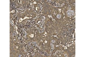 IHC analysis of EIF5 using anti-EIF5 antibody (ABIN7599722). (EIF5 anticorps  (AA 11-423))