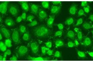 Immunofluorescence analysis of A549 cells using TSEN2 Polyclonal Antibody (TSEN2 anticorps)