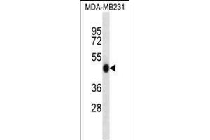 WIPI2 Antibody (N-term) (ABIN657237 and ABIN2846338) western blot analysis in MDA-M cell line lysates (35 μg/lane). (WIPI2 anticorps  (N-Term))