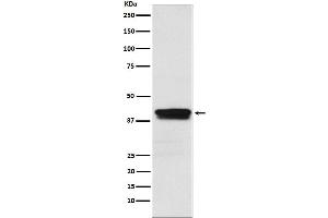 Western blot analysis of MBNL1 expression in Jurkat cell lysate.
