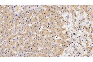 Detection of ERK2 in Human Liver Tissue using Polyclonal Antibody to Extracellular Signal Regulated Kinase 2 (ERK2)