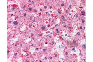 Immunohistochemistry (IHC) image for anti-Arginase, Liver (ARG1) (N-Term) antibody (ABIN2782309)
