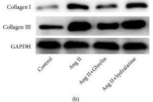 Ghrelin lowered systolic blood pressure and collagen I and collagen III protein expression in the myocardium of Ang II-infused rats. (GAPDH anticorps  (AA 1-335))