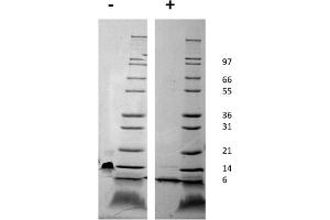 SDS-PAGE of Mouse Stromal Cell-Derived Factor-1 alpha (CXCL12) Recombinant Protein SDS-PAGE of Mouse Stromal Cell-Derived Factor-1 alpha (CXCL12) Recombinant Protein. (CXCL12 Protéine)