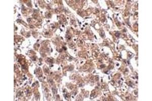 Immunohistochemistry of HAAO in human liver tissue with HAAO antibody at 2.