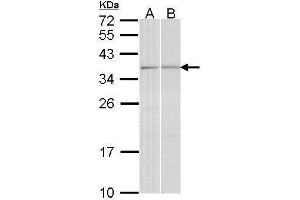 WB Image Sample (30 ug of whole cell lysate) A: A431 , B: Hela 12% SDS PAGE antibody diluted at 1:1000 (TGIF2 anticorps  (C-Term))