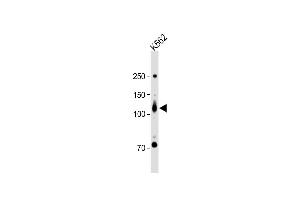 anti-Receptor Tyrosine Kinase-Like Orphan Receptor 2 (ROR2) (AA 19-50), (N-Term) antibody