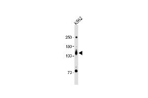 All lanes : Anti-ROR2 Antibody (N-term) at 1:1000 dilution + K562 whole cell lysate Lysates/proteins at 20 μg per lane. (ROR2 anticorps  (N-Term))