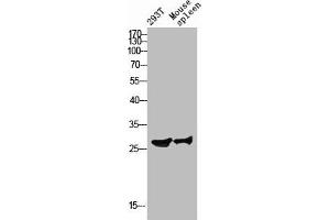 Western blot analysis of 293T mouse-spleen lysis using Ribosomal Protein S4Y1 antibody. (RPS4Y1 anticorps  (C-Term))