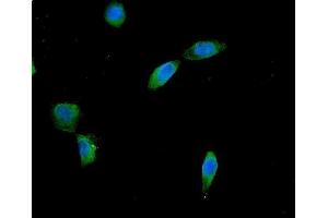 IF analysis of AES using anti-AES antibody (ABIN6719264). (AES anticorps  (AA 69-138))