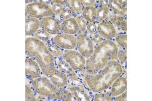 Immunohistochemistry of paraffin-embedded mouse kidney using NLRC4 antibody at dilution of 1:100 (x400 lens). (NLRC4 anticorps)