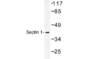 Image no. 1 for anti-Septin 1 (SEPT1) antibody (ABIN272245) (Septin 1 anticorps)