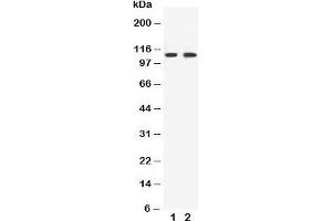 Western blot testing of EphB3 antibody and Lane 1:  HeLa;  2: A549 cell lysate (EPH Receptor B3 anticorps  (C-Term))