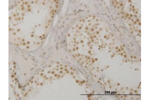 Image no. 1 for anti-Oxidative-Stress Responsive 1 (OXSR1) (AA 351-450) antibody (ABIN599103) (OXSR1 anticorps  (AA 351-450))