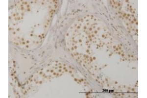 Image no. 1 for anti-Oxidative-Stress Responsive 1 (OXSR1) (AA 351-450) antibody (ABIN599103)