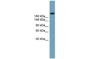 WB Suggested Anti-ABCA12 Antibody Titration:  0. (ABCA12 anticorps  (Middle Region))