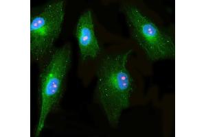 IF analysis of RRP1 and Tubulin beta using anti-RRP1 antibody (ABIN7600683) and anti-Tubulin beta antibody (ABIN7602744). (RRP1 anticorps  (AA 22-237))