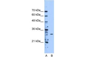 Western Blotting (WB) image for anti-Methyltransferase Like 1 (METTL1) antibody (ABIN2463199) (METTL1 anticorps)