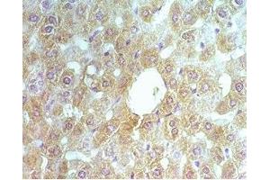 Rat liver tissue was stained by rabbit Anti-ABCB6 (260-301) (Human, Mouse ) Serum