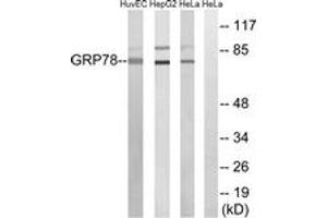 Western blot analysis of extracts from HuvEc/HepG2/HeLa cells, using GRP78 Antibody.