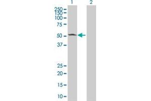 Lane 1: CAMK2A transfected lysate ( 52. (CAMK2A 293T Cell Transient Overexpression Lysate(Denatured))