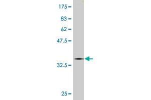 Western Blot detection against Immunogen (36. (CNOT2 anticorps  (AA 441-540))