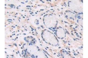 Detection of CECR1 in Human Stomach Tissue using Polyclonal Antibody to Cat Eye Syndrome Chromosome Region, Candidate 1 (CECR1) (CECR1 anticorps  (AA 30-511))