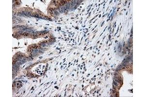 Immunohistochemical staining of paraffin-embedded Kidney tissue using anti-LIPG mouse monoclonal antibody. (LIPG anticorps)