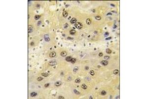 Image no. 1 for anti-Hypoxia Inducible Factor 1, alpha Subunit (Basic Helix-Loop-Helix Transcription Factor) (HIF1A) (C-Term) antibody (ABIN360059)