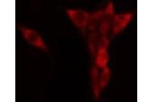 ABIN6268950 staining HeLa?