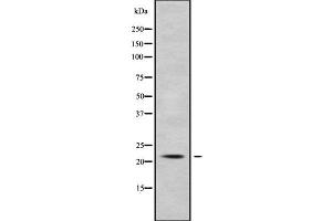 Western blot analysis of KCNMB1 using COS7 whole cell lysates
