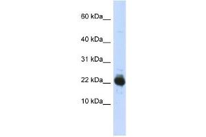 UBE2L3 antibody used at 1 ug/ml to detect target protein. (UBE2L3 anticorps  (Middle Region))