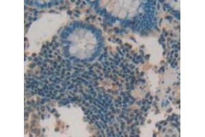 Figure. (ULBP2 anticorps  (AA 26-246))