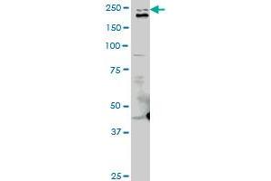 TLN1 monoclonal antibody (M06), clone 2E10. (TLN1 anticorps  (AA 1052-1149))