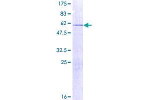 Image no. 1 for Alport Syndrome, Mental Retardation, Midface Hypoplasia and Elliptocytosis Chromosomal Region Gene 1 (AMMECR1) (AA 1-296) protein (GST tag) (ABIN1344988)