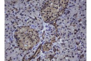 Image no. 1 for anti-Zinc Finger and SCAN Domain Containing 4 (ZSCAN4) (AA 164-433) antibody (ABIN1490994)