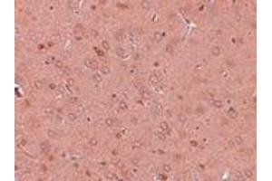 Immunohistochemistry (IHC) image for anti-Golgi Membrane Protein 1 (GOLM1) (Middle Region) antibody (ABIN1030941) (GOLM1 anticorps  (Middle Region))