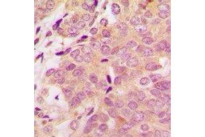 Immunohistochemistry (IHC) image for anti-S100 Calcium Binding Protein A11 (S100A11) antibody (ABIN7308300)