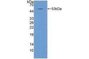 Detection of Recombinant IL6, Rabbit using Polyclonal Antibody to Interleukin 6 (IL6)