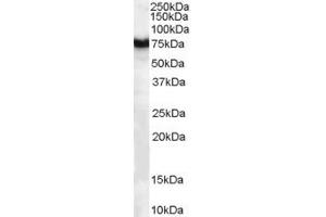 Western Blotting (WB) image for anti-Frizzled Family Receptor 8 (FZD8) (AA 684-694) antibody (ABIN297075) (FZD8 anticorps  (AA 684-694))