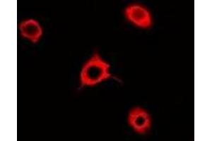 Immunofluorescent analysis of Rac 1 staining in A549 cells.