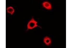 Immunofluorescent analysis of Rac 1 staining in A549 cells.