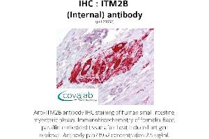 Image no. 1 for anti-Integral Membrane Protein 2B (ITM2B) (Internal Region) antibody (ABIN1736083) (ITM2B anticorps  (Internal Region))