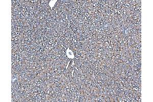 IHC analysis of SLC10A1/NTCP1 using anti-SLC10A1/NTCP1 antibody (ABIN7601234).