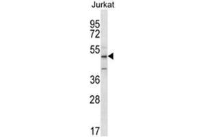 ABI2 Antibody (N-term) western blot analysis in Jurkat cell line lysates (35 µg/lane).