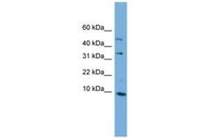 Image no. 1 for anti-Chromosome 16 Open Reading Frame 61 (C16orf61) (C-Term) antibody (ABIN6744182)