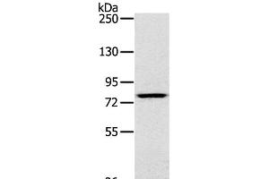 Western Blot analysis of K562 cell using RPS6KA1 Polyclonal Antibody at dilution of 1:400 (RPS6KA1 anticorps)